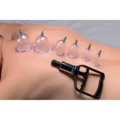 Master Series Sukshen 6 Piece Cupping Set With Acu-Points